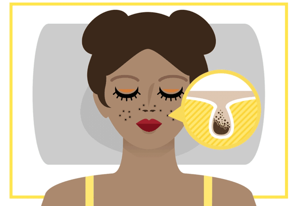 值得回购的清洁面膜有哪些 黑头 清洁 清洁面膜 美容 第1张