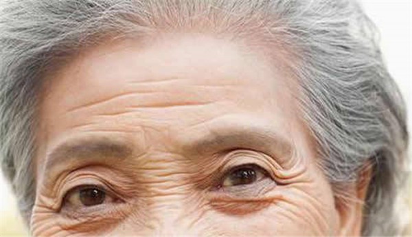 眼角纹是怎么形成的 护肤 第1张
