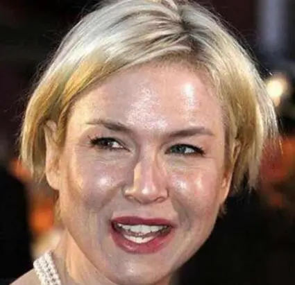 皮肤又油又干怎么回事，解决皮肤又油又干的攻略 皮肤又油又干 美容 第2张