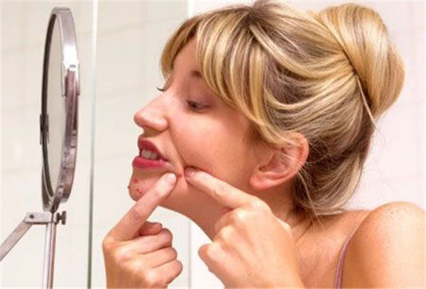 长痘是福，让痘痘告诉你身体哪出毛病了 护肤 第7张