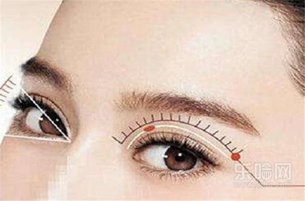 埋线双眼皮是怎么弄的 护肤 第2张