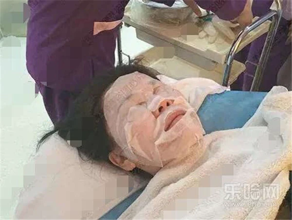 镭射净肤过程图 护肤 第6张