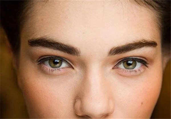 开眼角后注意事项 护肤 第3张
