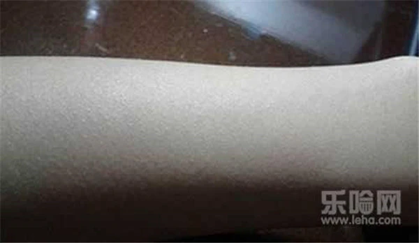 磨砂膏能去鸡皮肤吗 护肤 第10张