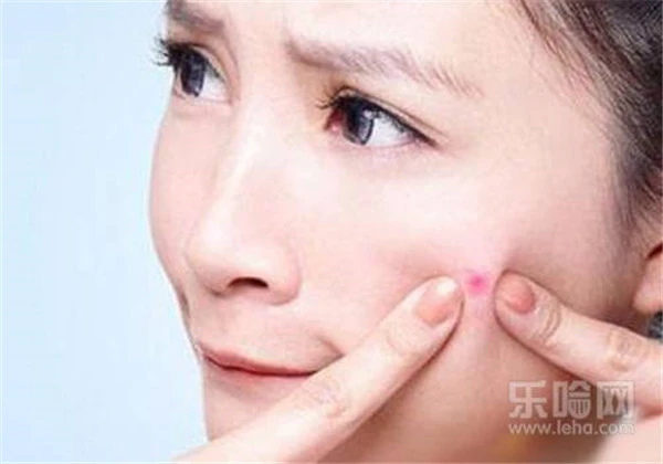 秋冬季皮肤问题 护肤 第3张