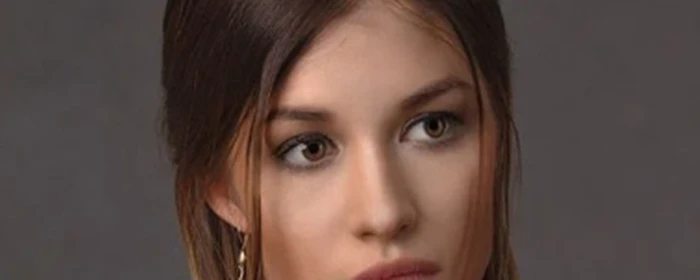 掉头发是什么原因引起的 掉头发 美妆 第3张