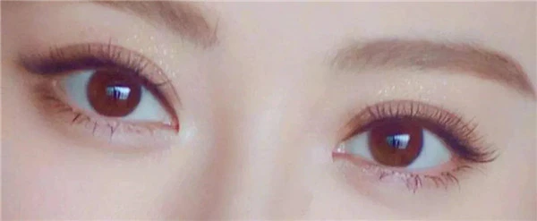 如何选择合适的双眼皮类型，双眼皮的种类 双眼皮 第11张