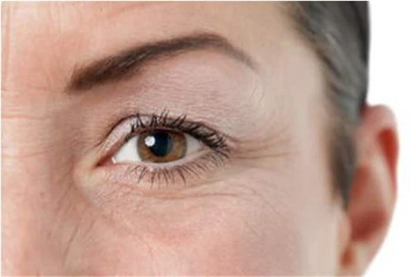 预防女人眼皮下垂的方法：避免浓妆、远离辐射等 女人 眼皮 第3张