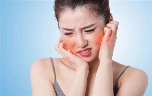 用完水乳以后脸热热的怎么办 水乳 水乳过敏 美妆 第1张