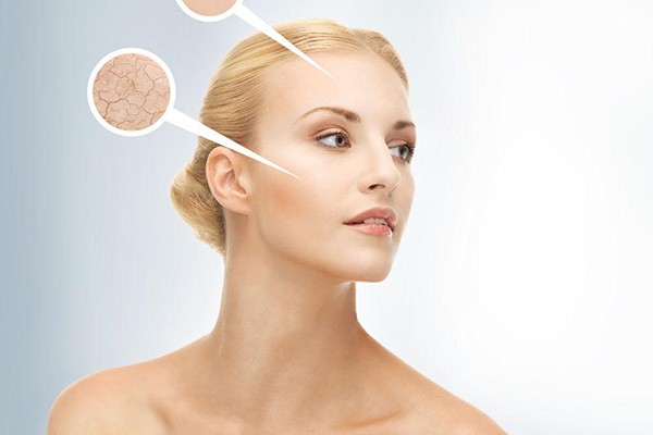 脸上皮肤干燥，起皮应该怎么办 面霜 第1张