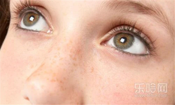 为什么女人会长黄褐斑 护肤 第4张 为什么女人会长黄褐斑 护肤 第4张