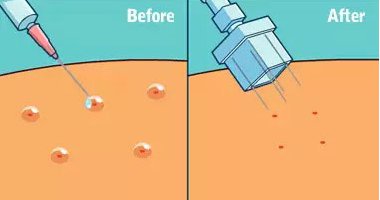 做水光24小时后化妆了可以吗 水光针 水光化妆 美妆 第1张