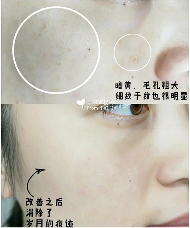 给肌肤安个小弹簧，25岁以后的我活得像极了爱情的模样 片仔癀 小弹簧 美妆 第2张