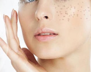 药水祛斑的危害与效果 药水祛斑|药水祛斑危害 药水祛斑 药水祛斑危害 美妆 第1张