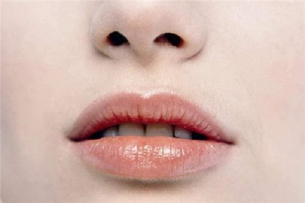 唇纹是怎么产生的，为什么会这么深，怎样做才可以何淡化唇纹 嘴唇 第2张