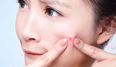 脸颊两边老是长痘痘是怎么回事 长痘 脸颊长痘 美妆 第1张