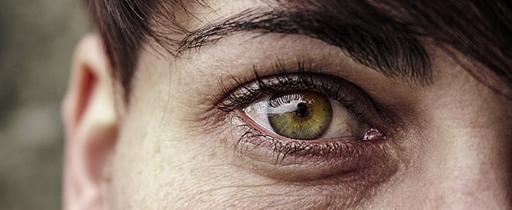 怎么样才能去除黑眼圈 黑眼圈 美妆 第2张