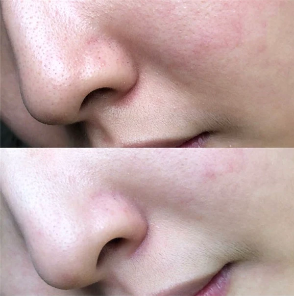 科颜氏白泥面膜怎么样，科颜氏白泥面膜的正确使用方法 科颜氏 面膜 第4张