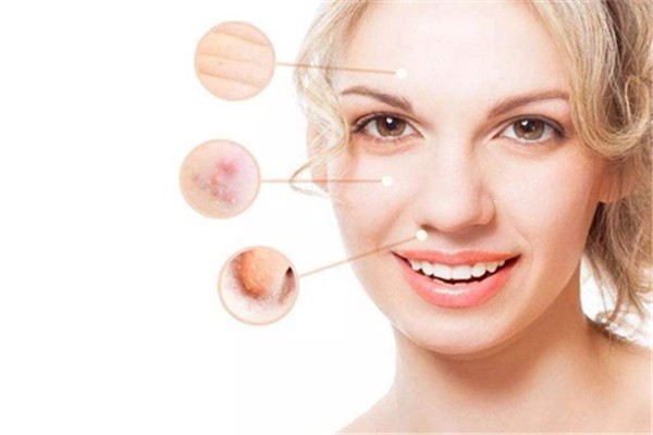 冻龄肌肤要从年轻的时候做起，频射可恢复肌肤弹性 冻龄 肌肤 第1张