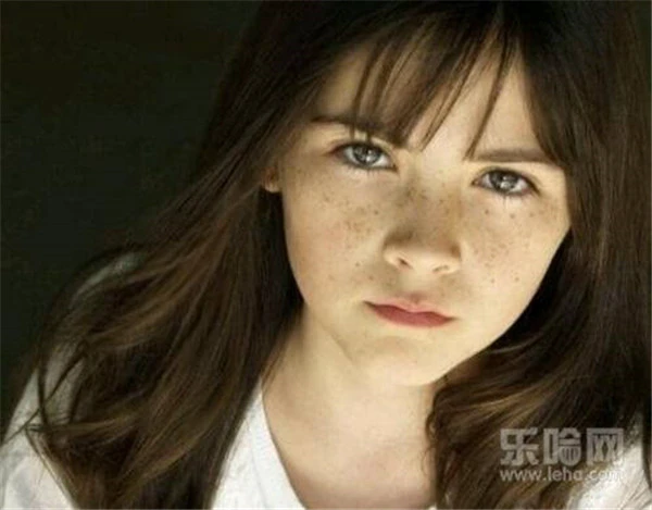 光子祛斑后如何保养 护肤 第5张