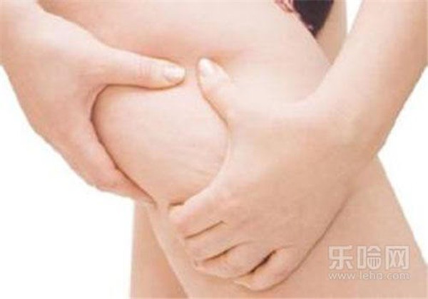 膨胀纹会自动消失么 护肤 第1张