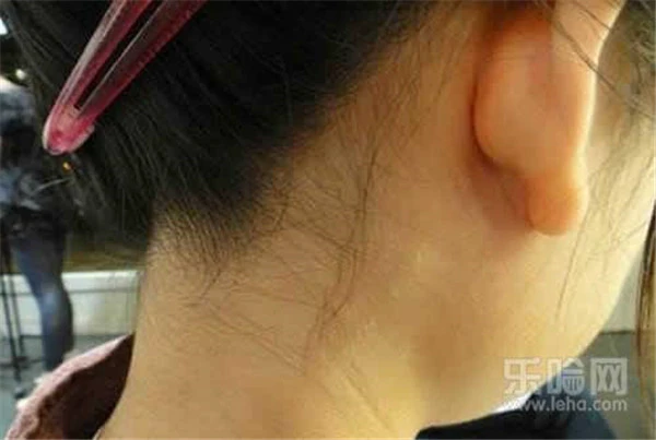 海藻面膜容易过敏吗 护肤 第5张