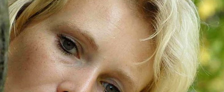 皮肤怎样祛斑 祛斑 美妆 第2张