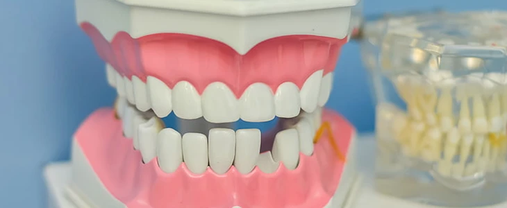 美白牙齿的方法 美白 牙齿 美妆 第3张