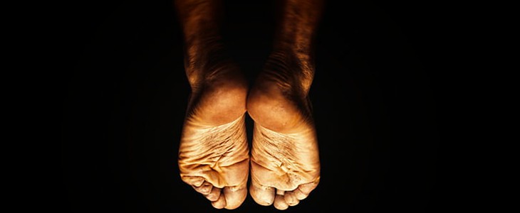 夏天脚臭怎么办 夏天 脚臭 美妆 第1张