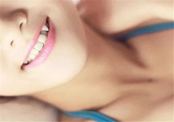 矫正虎牙会改变脸型吗 护肤 第3张 矫正虎牙会改变脸型吗 护肤 第3张