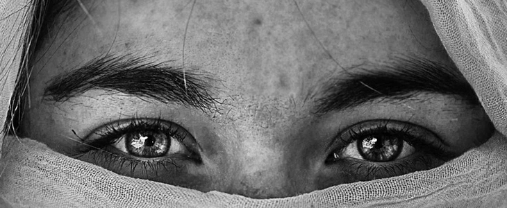 如何减少青春痘 青春痘 美妆 第2张