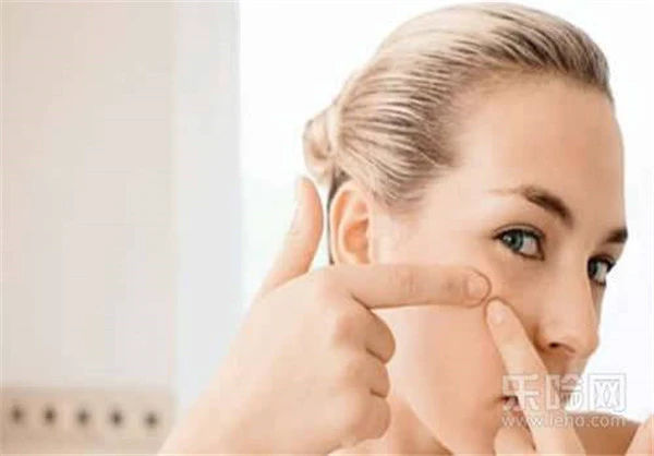 闭口粉刺可以挑吗 护肤 第2张