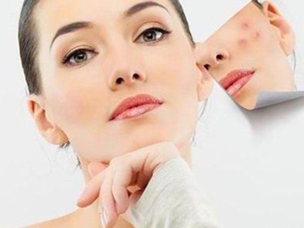 为了消除痘痘，需要怎么办 自己的 第1张