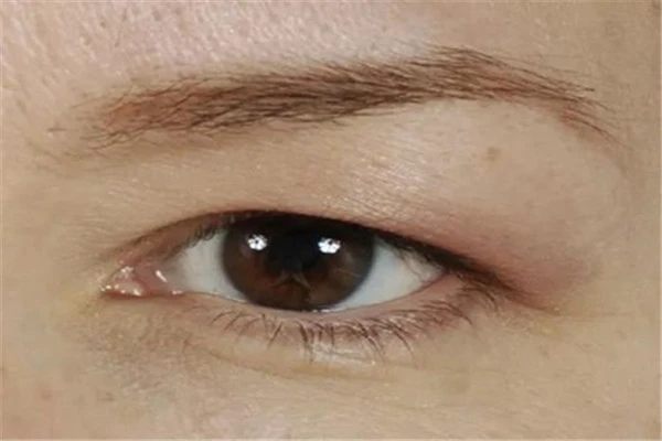 预防女人眼皮下垂的方法：避免浓妆、远离辐射等 女人 眼皮 第2张