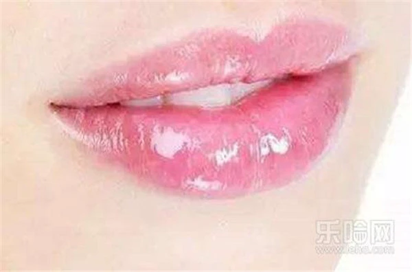 漂唇增生怎么处理 护肤 第6张