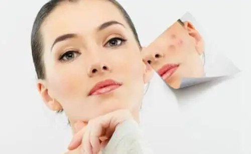 去痘印最有效的方法，导致痤疮形成疤痕的原因 护肤 第2张