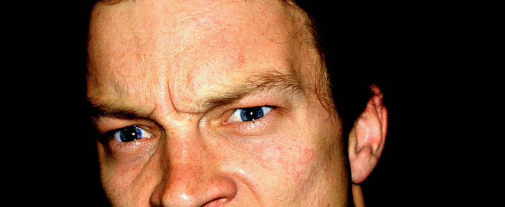 痘印多久能消除 痘印 美妆 第2张