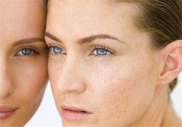 维生素E能去祛斑吗，用对了想不美都不行 护肤 第1张