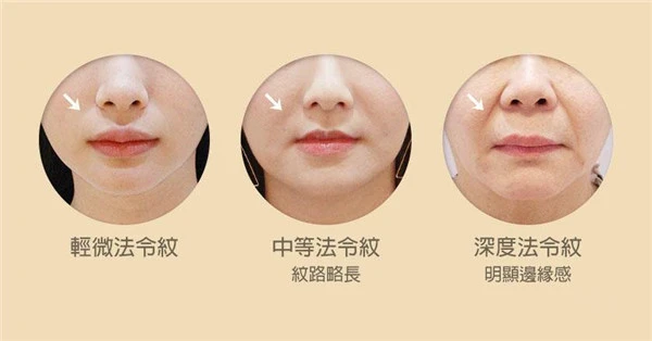 法令纹形成的原因，预防法令纹的方式方法 法令纹 预防 第3张