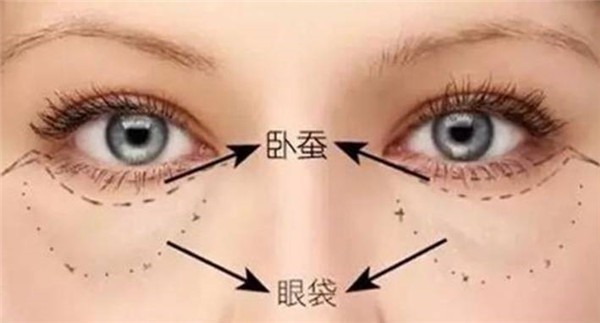 眼袋贴怎么用 美妆 第1张