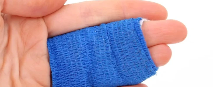 冻疮是怎么形成的 冻疮 美妆 第2张