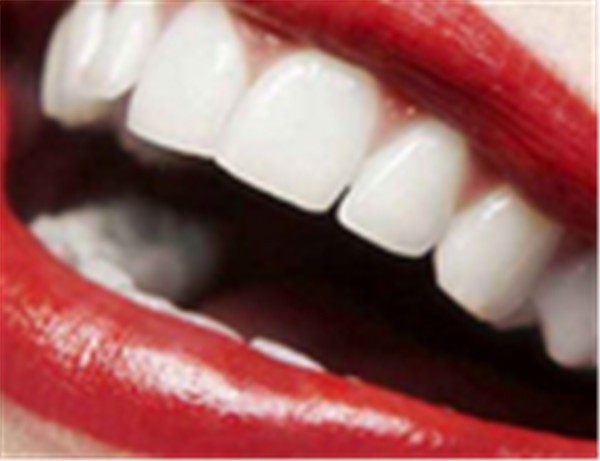冷光美白牙齿后悔了你必须知道的5点危害 美白 牙齿 第1张