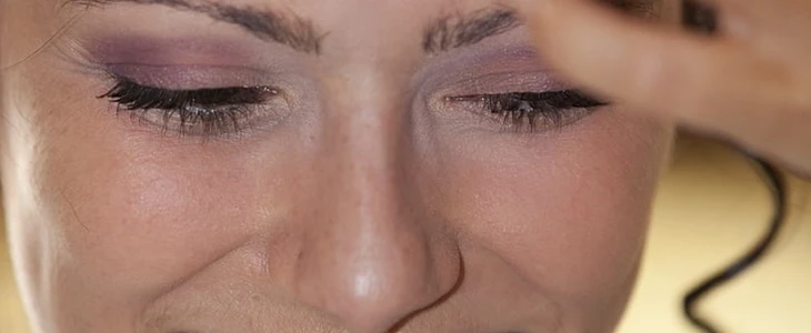 黑头是怎么形成的 黑头 美妆 第2张