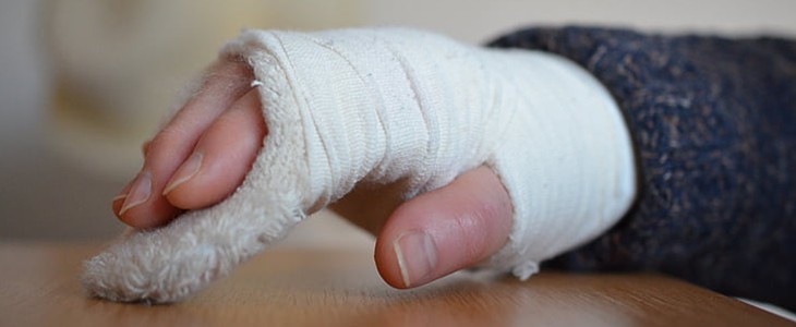 冻疮是怎么形成的 冻疮 美妆 第1张