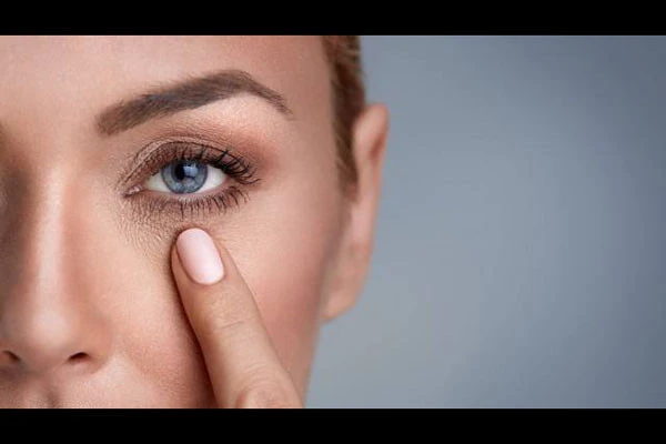 泪沟是怎么来的，泪沟要怎么消除 皮肤 第3张