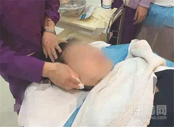 镭射净肤过程图 护肤 第4张