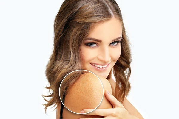 脸上长斑的原因有哪些，斑是怎么长出来的 皮肤 第2张