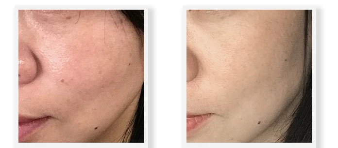 本来只想「伪素颜」,没想到爱怡美素颜霜连色斑都帮我祛除了 素颜 爱怡美素颜霜 美妆 第6张 本来只想「伪素颜」,没想到爱怡美素颜霜连色斑都帮我祛除了 素颜 爱怡美素颜霜 美妆 第6张