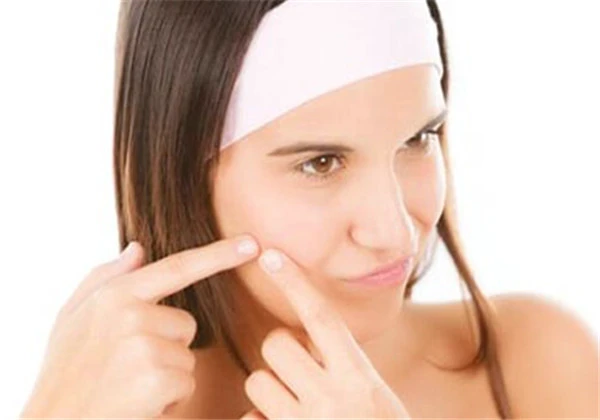 挤痘痘挤出来的是什么 护肤 第3张