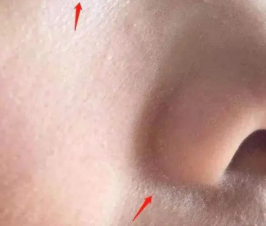 脸上化妆老是脱皮浮粉怎么办，上粉贴服小技巧 浮粉 化妆脸上老是脱皮浮粉 化妆脸上老是脱皮浮粉怎么办 美容 第2张